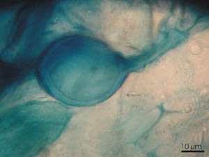 Arbuscular mycorrhizal infection of a medicinal plant root stained with 0.05% Aniline blue - note vesicle (photo by Karen Cloete).